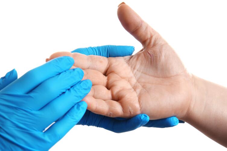 Как лечить трещины на пальцах рук?