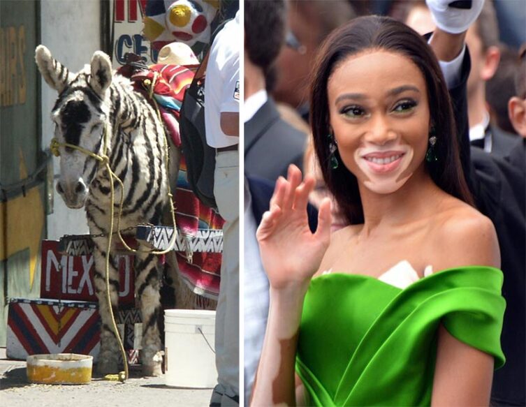 Слева — ослик-зонки. Справа — модель Винни Харлоу по прозвищу «девушка-зебра»
