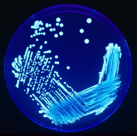 Legionella sp. под ультрафиолетовым излучением