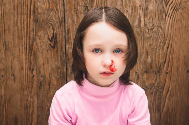 Почему у ребенка идет кровь из носа?