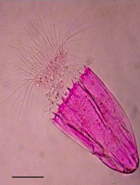 Лорицифера Spinoloricus cinziae, обитающая в бескислородной среде. Окрашивание бенгальским розовым. Масштабная линейка 50 мкм