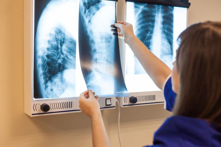 Насколько опасна рентгенодиагностика?