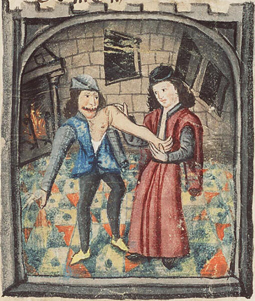 Врач, вправляющий руку. Иллюстрация из трактата Chirurgia Magna французского хирурга Ги де Шолиака, ок. 1450 г.