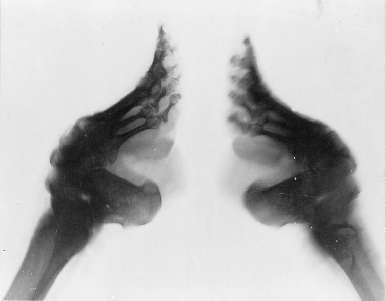 Рентгеновский снимок искалеченных ног